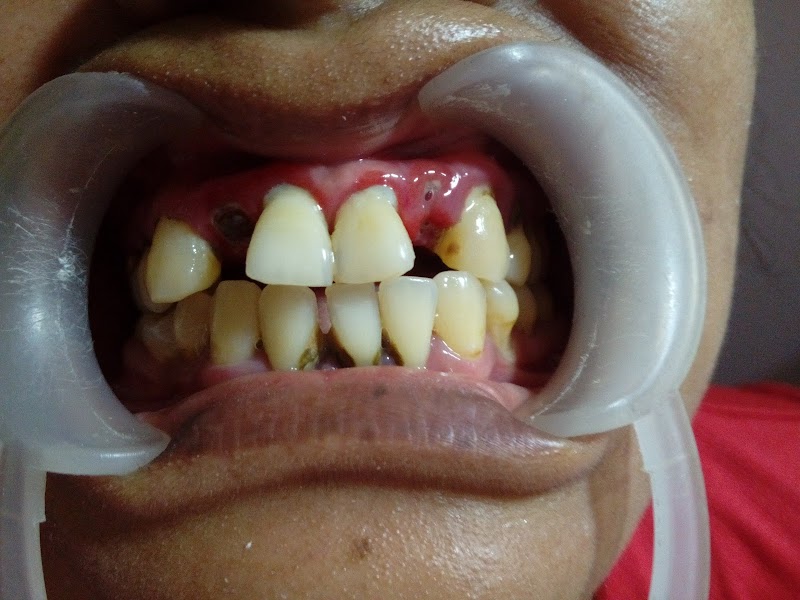 Ahli gigi rizki di Semampir