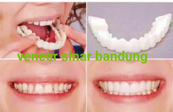 Dental Gigi Mas Fahri di Bojongloa Kidul