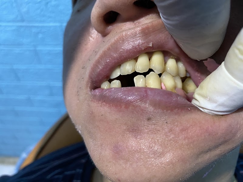 Faisal gigi di Kota Surabaya