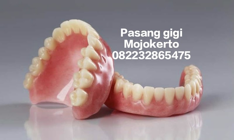 Pasang Gigi Mojokerto di Kota Mojokerto